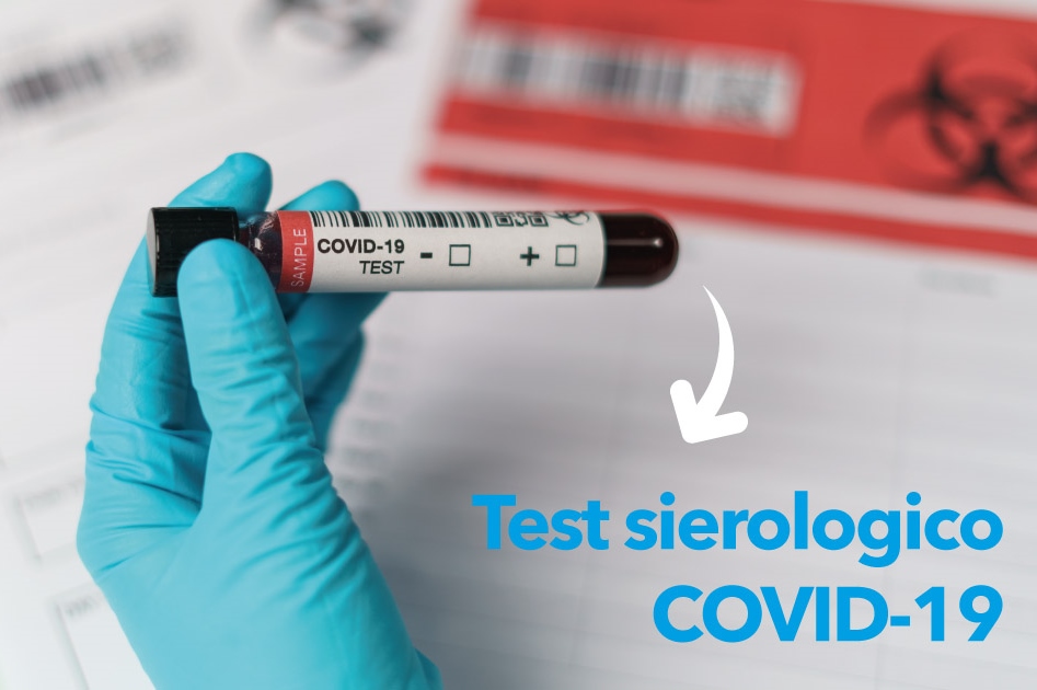 test sierologico COVID 19